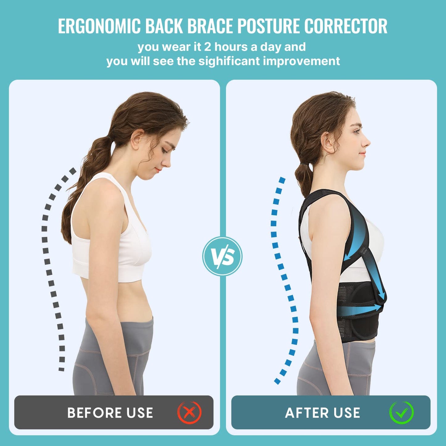 Geno Back Brace Posture Corrector for Men and Women